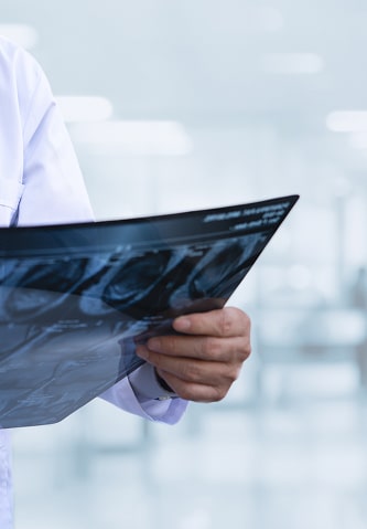 A medical professional looking over an X-ray