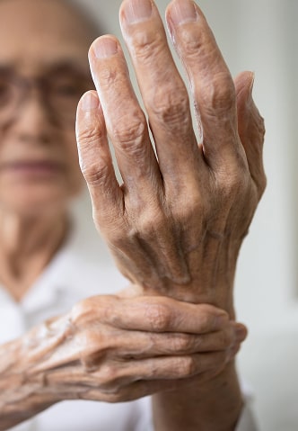 An elderly woman with arthritis